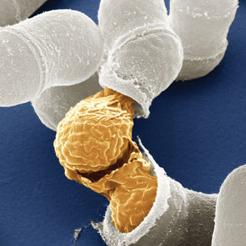 FISSION YEAST
